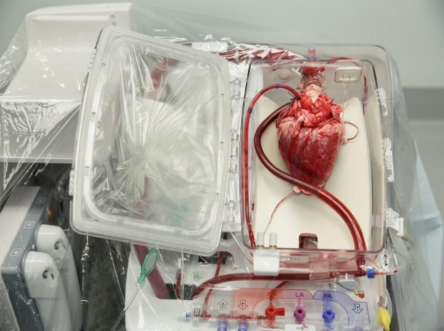 Heart transplant transport system