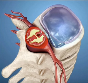 Spinal cord image WRONG! Spinal cord image WRONG!