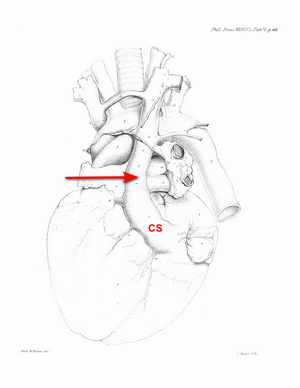 Marshall Plate VI - LPSVC Marshall Plate VI - LPSVC