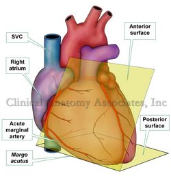 Acute margin of the heart. SVC= Superior vena cava