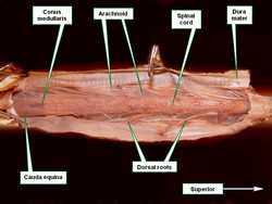 Spinal cord dissection, posterior view