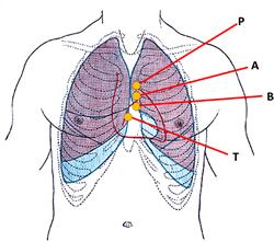 Anterior view of the thorax, showing surface relations of bones, lungs (purple), pleura (blue), and heart (red outline). P. Pulmonary valve. A. Aortic valve. B. Bicuspid valve. T. Tricuspid valve 