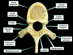 Superior view of a thoracic vertebra