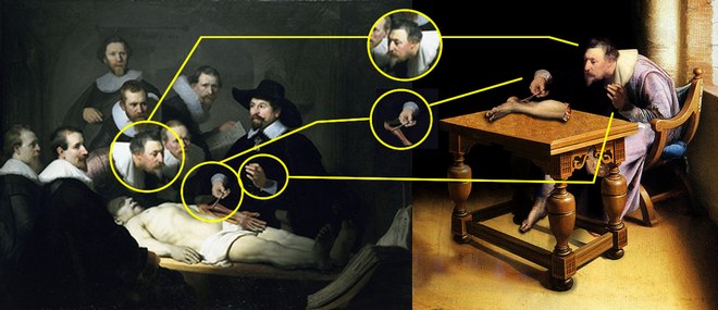 A comparison of Rembrandt's work and a painting said to depict Verheyen dissecting his own leg