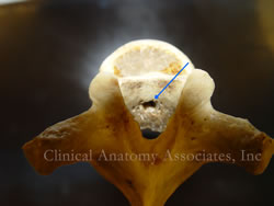 Thoracic vertebra, posterior view